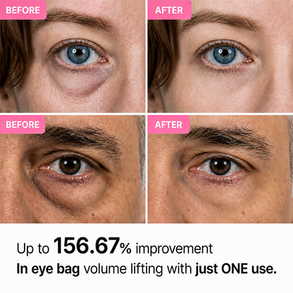 Ecliora Advanced Dr. Melaxin Eye Bag Cream