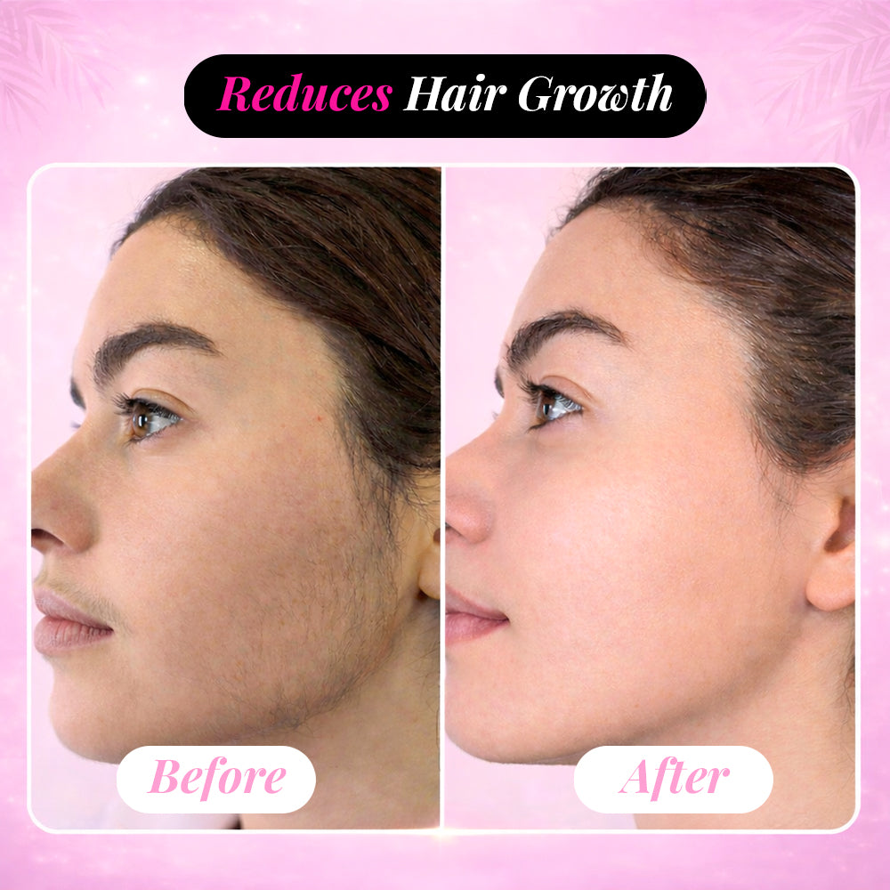 Ecliora Cyperus Hair Reduction Oil