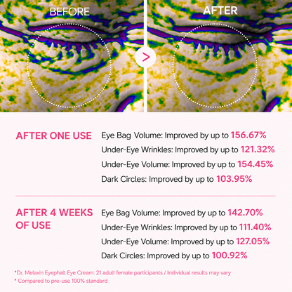 Ecliora Advanced Dr. Melaxin Eye Bag Cream
