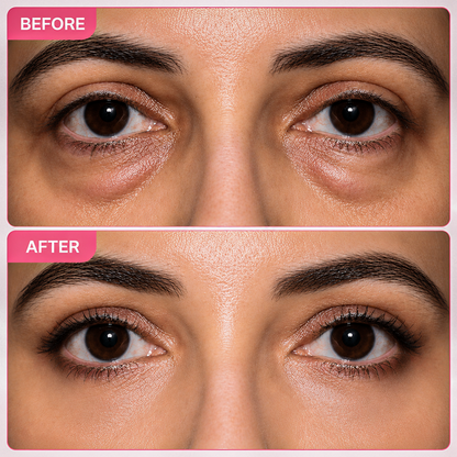 Ecliora Advanced Dr. Melaxin Eye Bag Cream